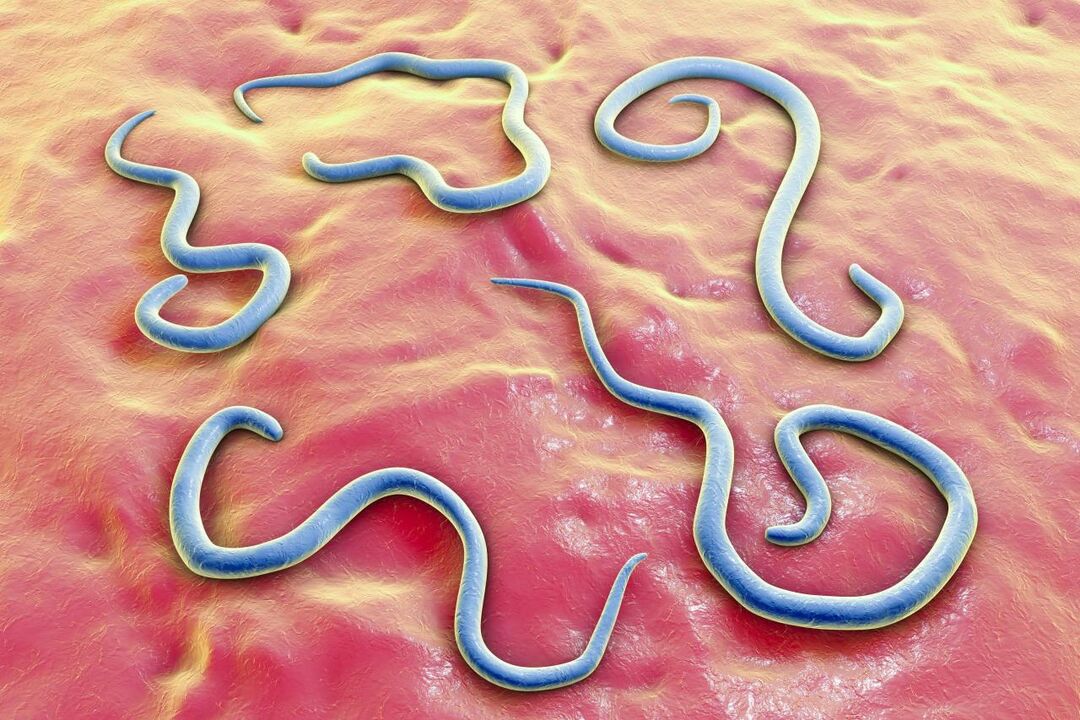 parasitäre Würmer am mënschleche Kierper