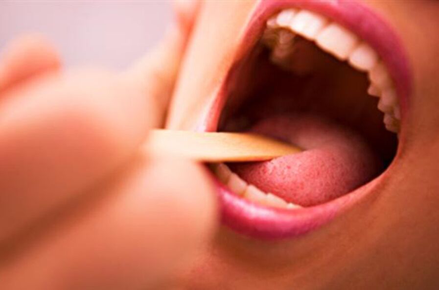 Aarte vu Parasiten am mënschleche Mond